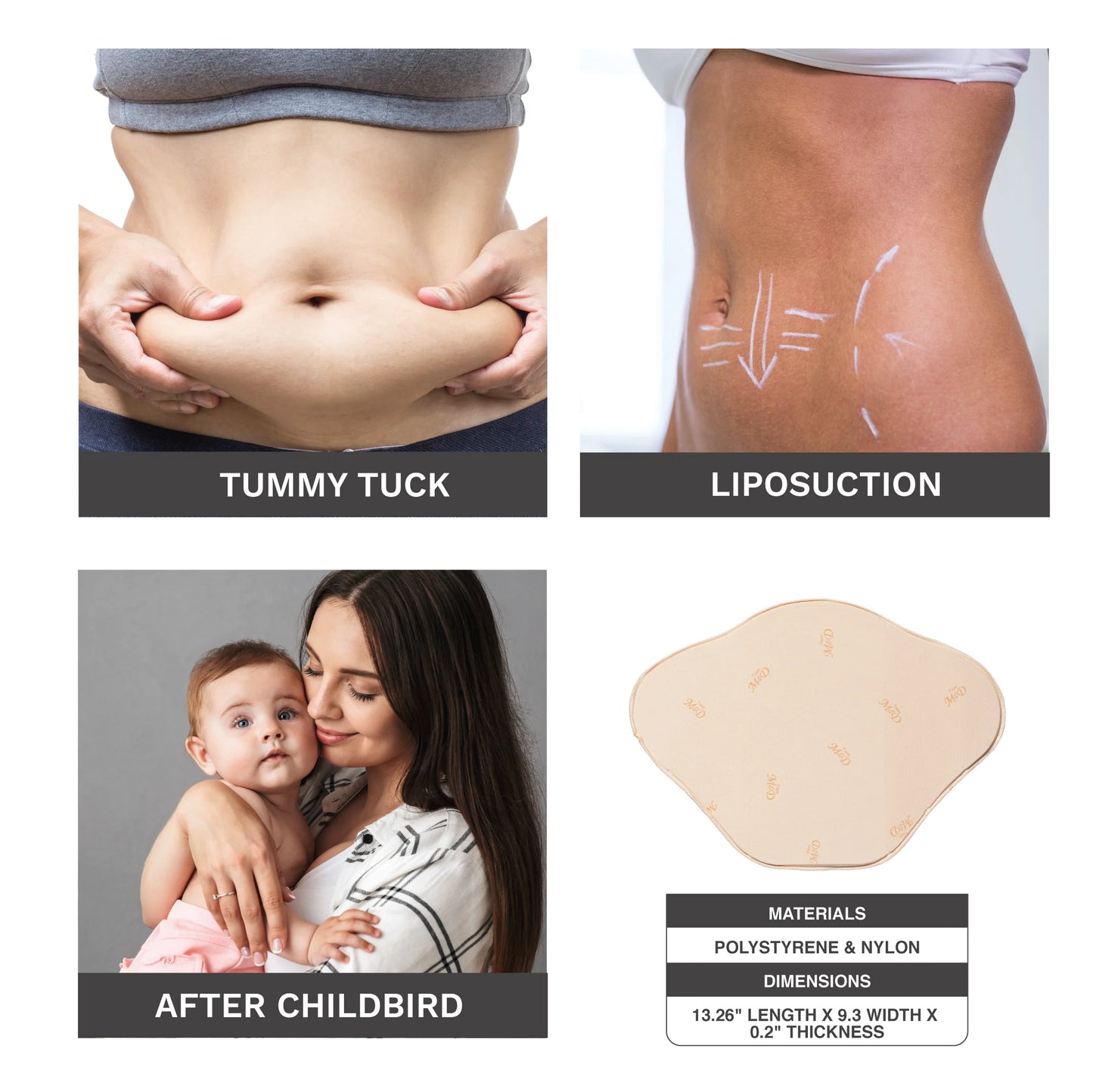 Tabla abdominal después de la liposucción / abdominoplastia 0104